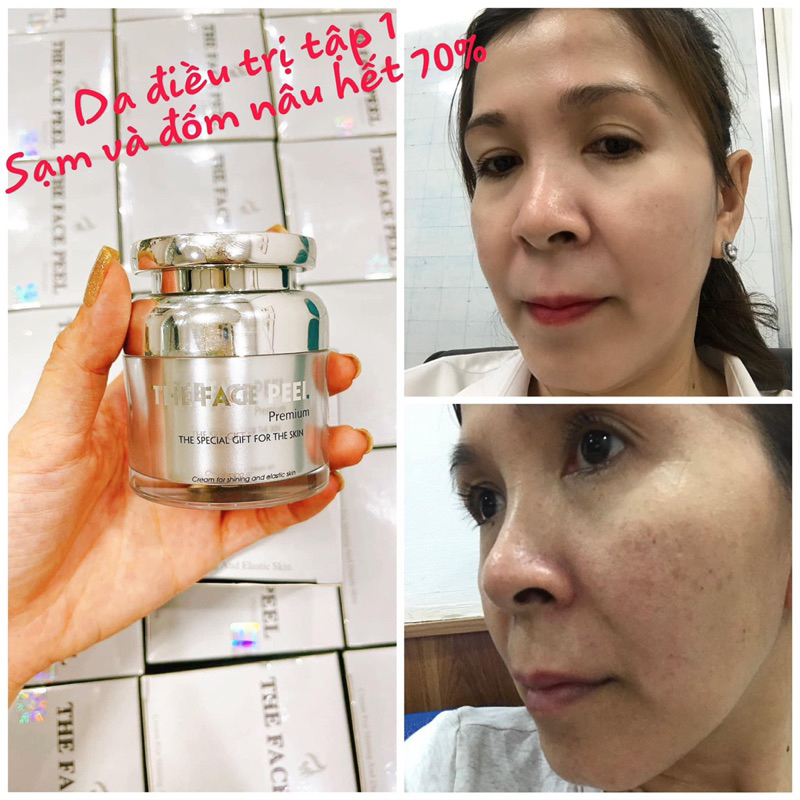 Kem tái tạo da the face peel