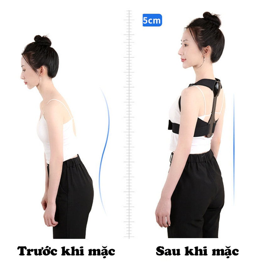 Đai lưng chống gù JUSUKE cảnh báo thông minh bảo hành 12 tháng