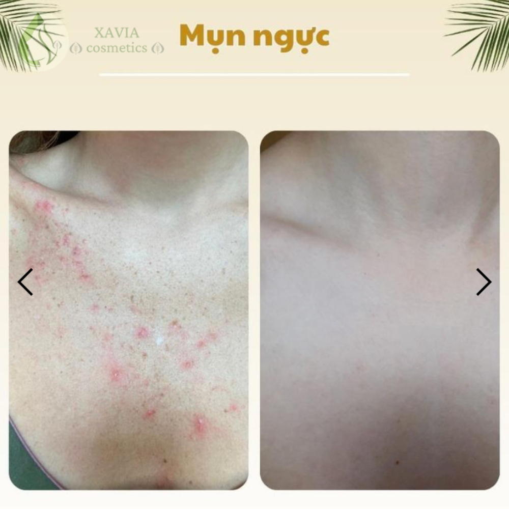 Tinh chất tắm dược liệu CLEAN, Chặn mụn ngăn thâm, Không lo tái phát, Dung tích 500ml - XAVIA COSMETICS