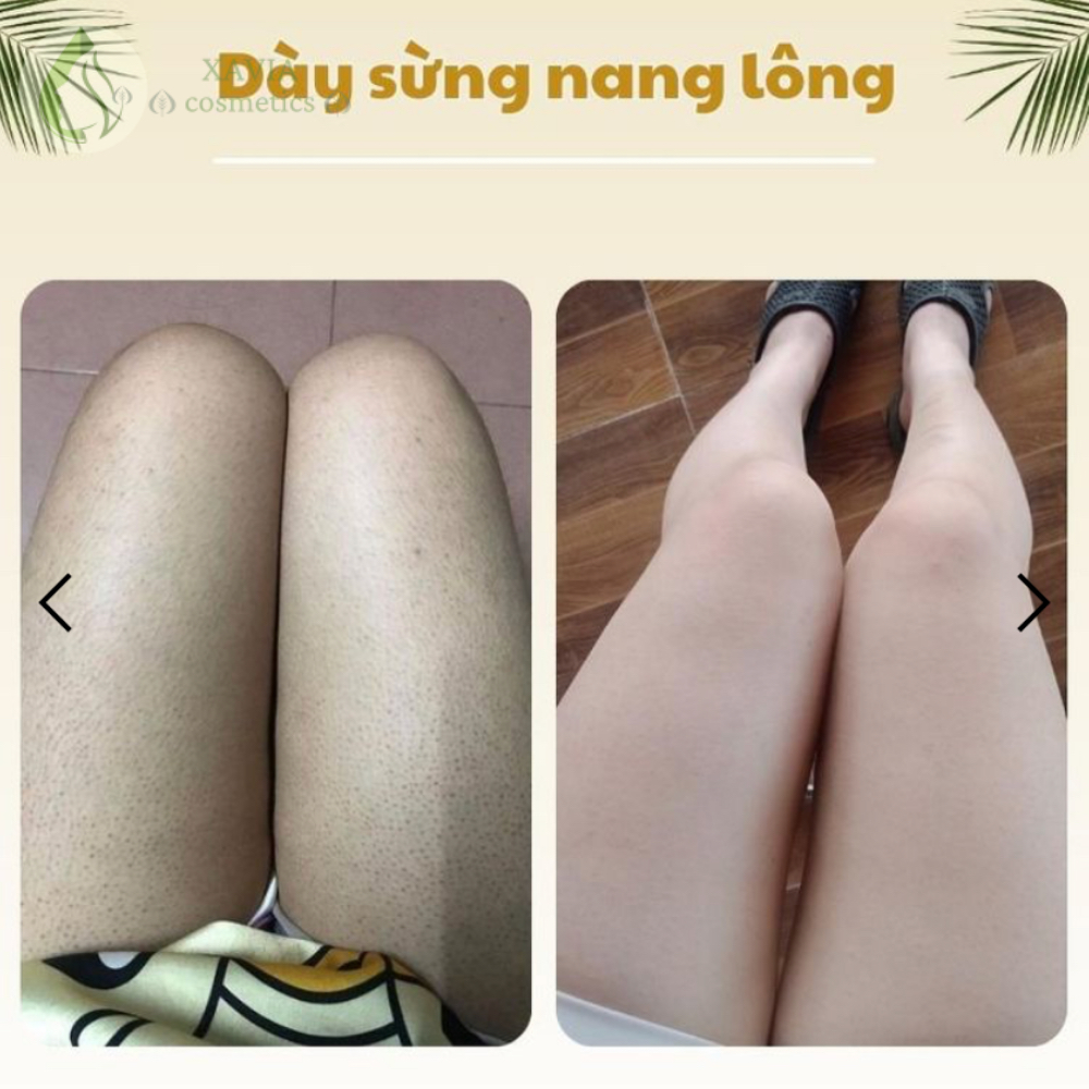 Tinh chất tắm dược liệu CLEAN, Chặn mụn ngăn thâm, Không lo tái phát, Dung tích 500ml - XAVIA COSMETICS