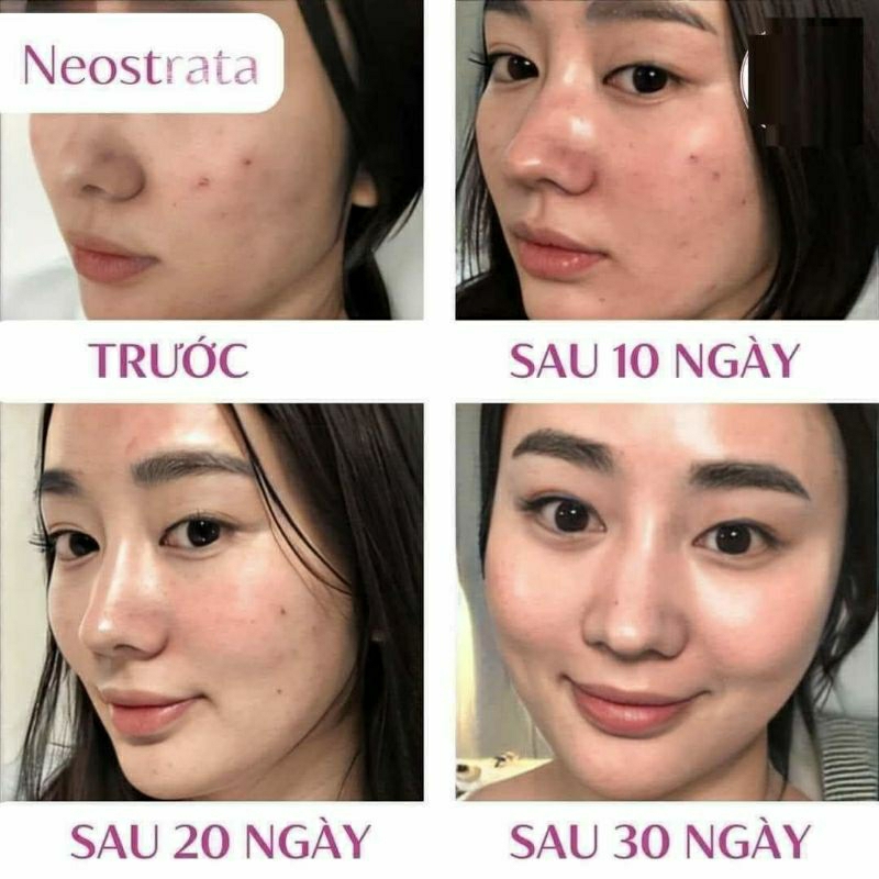 Toner Neostrata Oily Skin Solution AHA 8% sạch sâu và se khít lỗ chân lông 100ml