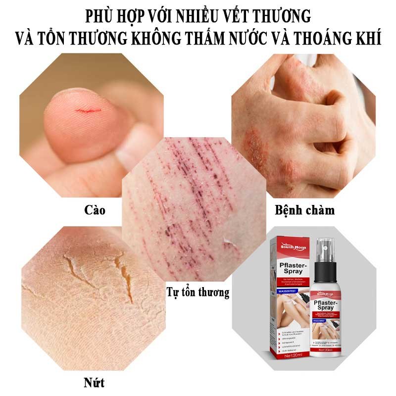 Xịt vết thương ITANA  giúp nhanh lành vết thương, hạn chế nhiễm trùng, sơ cứu vết bỏng, vết loét
