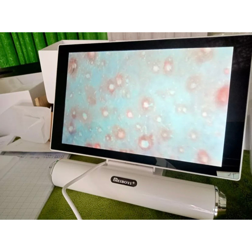 MÁY SOI DA IPAD MEIBOYI, MÀN HÌNH 11 INCH THẾ HỆ 2022, NHIỀU CHẾ ĐỘ SOI