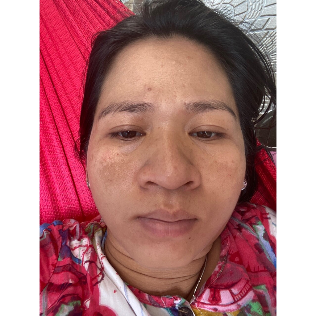 Serum phục hồi da Hoàng Trinh