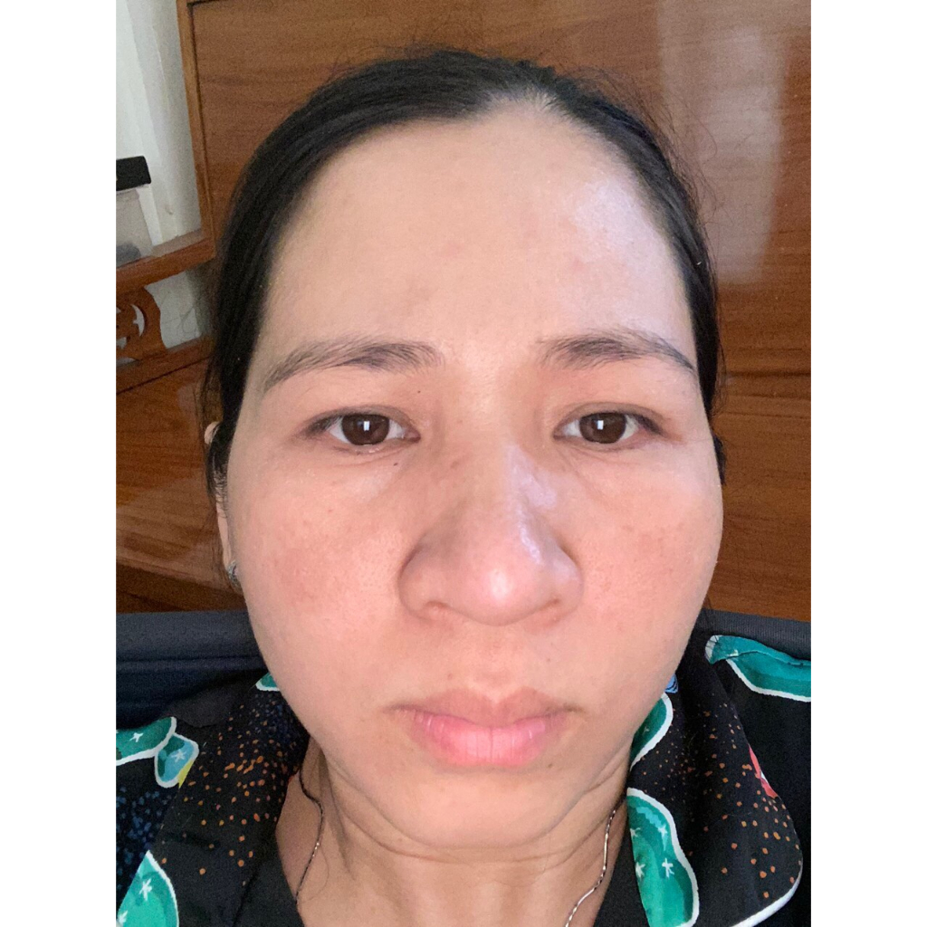 Serum phục hồi da Hoàng Trinh