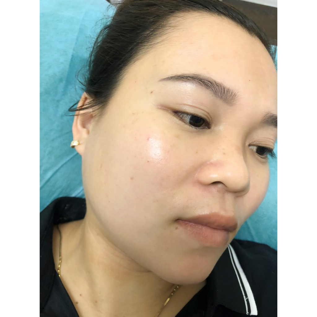 Serum phục hồi da Hoàng Trinh