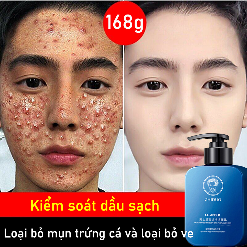 Sữa rửa mặt nam kem rửa mặt nam sữa rửa mặt mụn 168g Sảng khoái kiềm dầu Làm sạch sâu Loại bỏ mụn da cân bằng