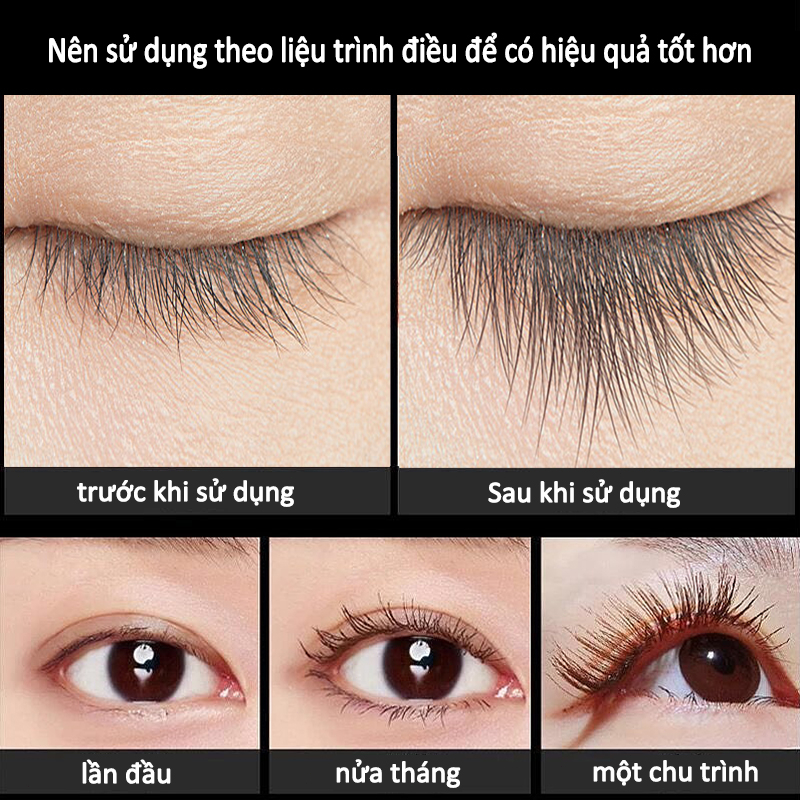 Tinh Chất Mọc Mi 10ML Kích Thích Mọc Lông Mi Làm Dày Lông Mi Nhanh Tự Nhiên Nuôi Dưỡng Mi Dài Và Cong