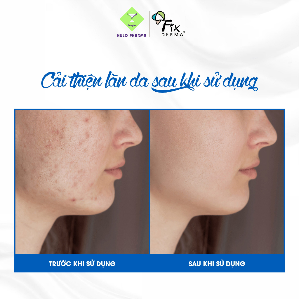 Kem Dưỡng Trắng Da Mặt Mờ Thâm Nám FIXDERMA Epifager Regale Brightening Cream Giúp Trắng Mịn, Đều Màu Da 30g