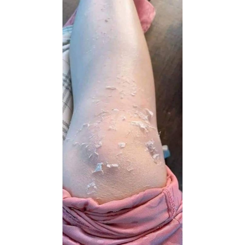 kem bong da DH white bong sau 5_7 ngày sử dụng( hũ 150gr)