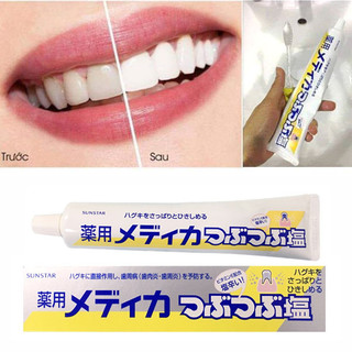 Kem đánh răng muối sunstar 170gr nhật bản