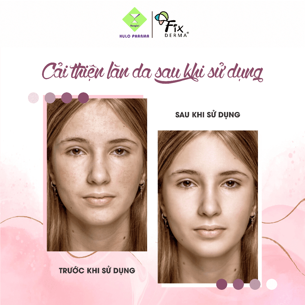 Kem Dưỡng Trắng Da Mặt Mờ Thâm Nám FIXDERMA Epifager Regale Brightening Cream Giúp Trắng Mịn, Đều Màu Da 30g