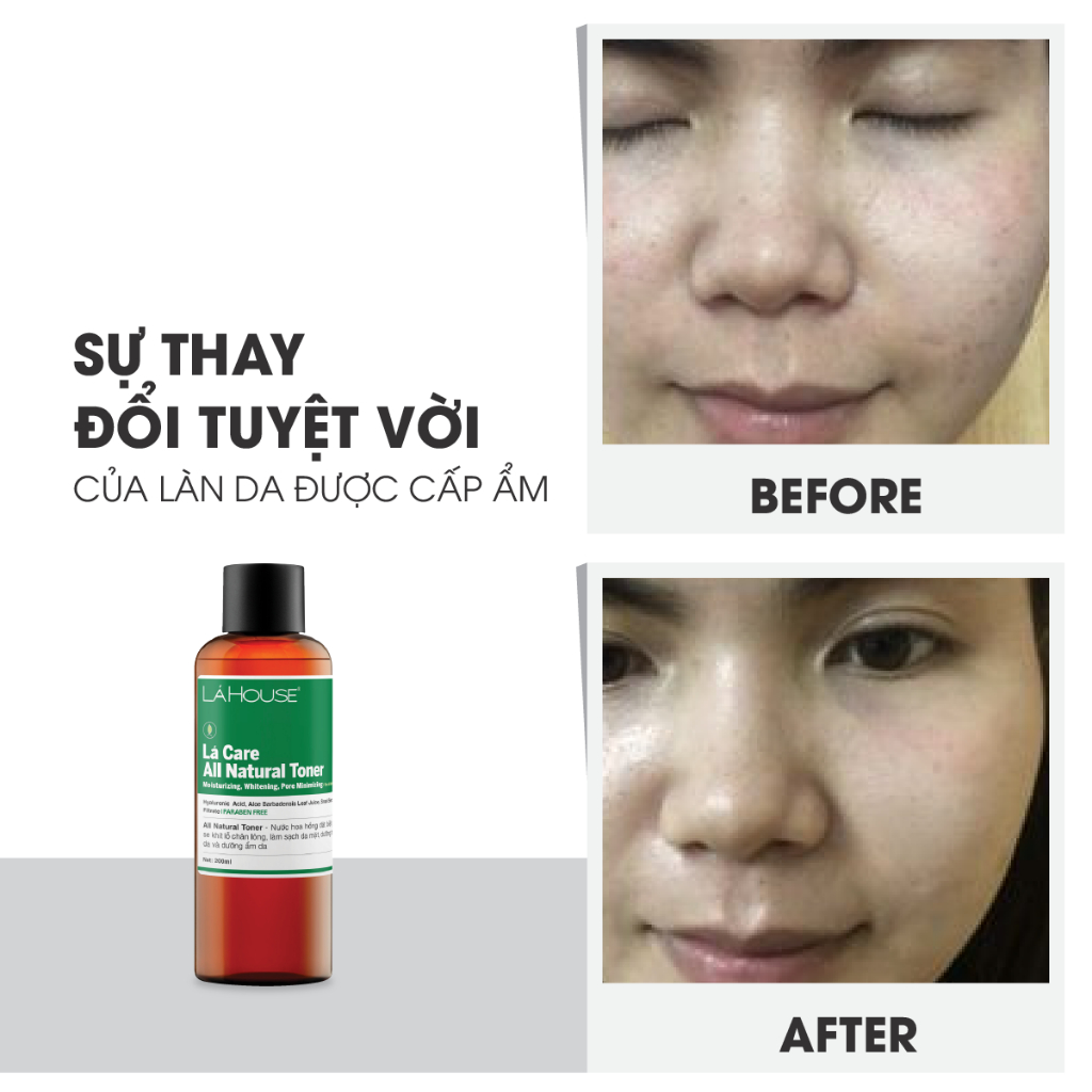 Nước hoa hồng ,giúp giảm nhờn trên da Lá House Lá Care All Natural Toner 200ml/100ml