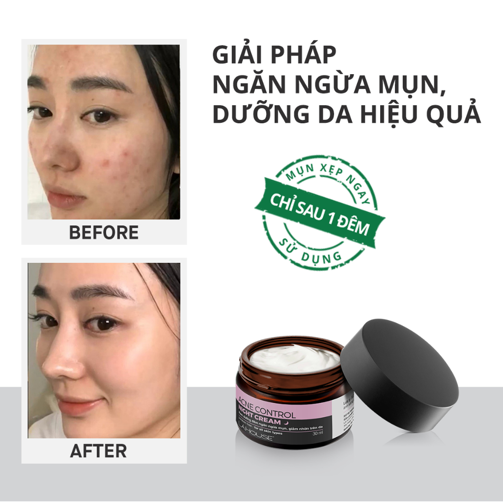 Kem dưỡng đêm dành cho da mụn,giảm thâm sẹo,sáng da Lá House Acne Control Night Cream 10ml/30ml
