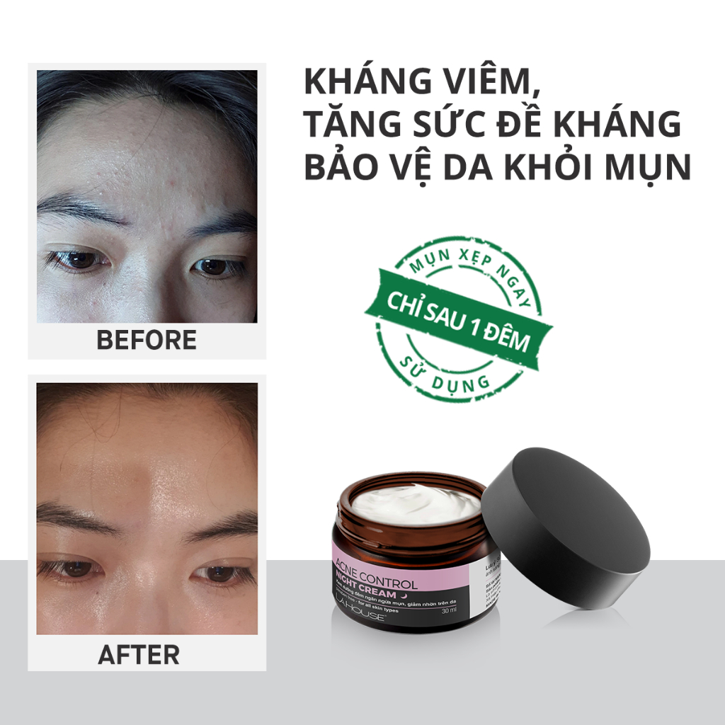 Kem dưỡng đêm dành cho da mụn,giảm thâm sẹo,sáng da Lá House Acne Control Night Cream 10ml/30ml