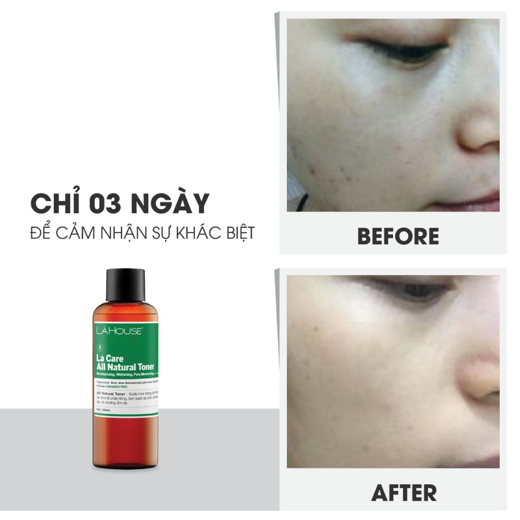 Nước hoa hồng ,giúp giảm nhờn trên da Lá House Lá Care All Natural Toner 200ml/100ml
