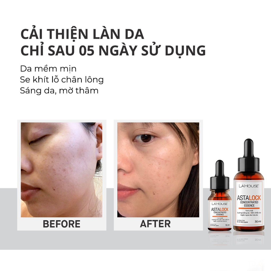 Tinh chất dưỡng trắng da Lá House Astalock Concentrated Essence 15ml/30ml