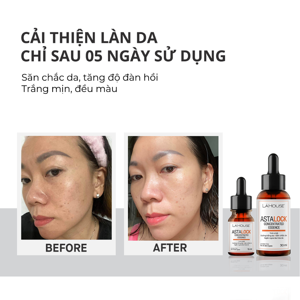 Tinh chất dưỡng trắng da Lá House Astalock Concentrated Essence 15ml/30ml