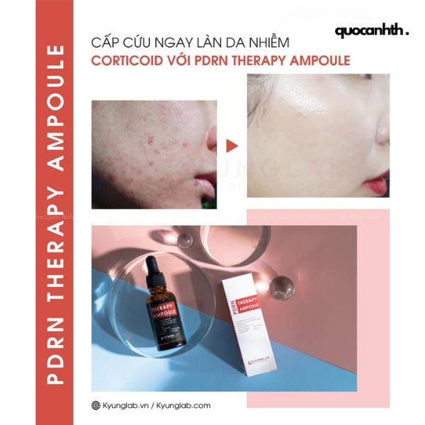 Serum Tế Bào Gốc KyungLab PDRN Therapy Ampoule - 30ml