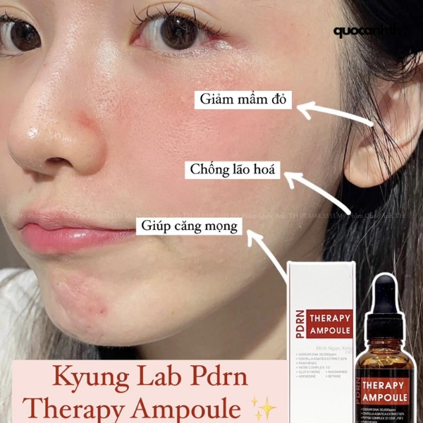 Serum Tế Bào Gốc KyungLab PDRN Therapy Ampoule - 30ml