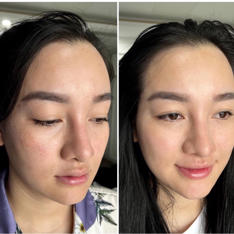 Serum nám moose+ xoá nám  50ml hạn dùng 2026