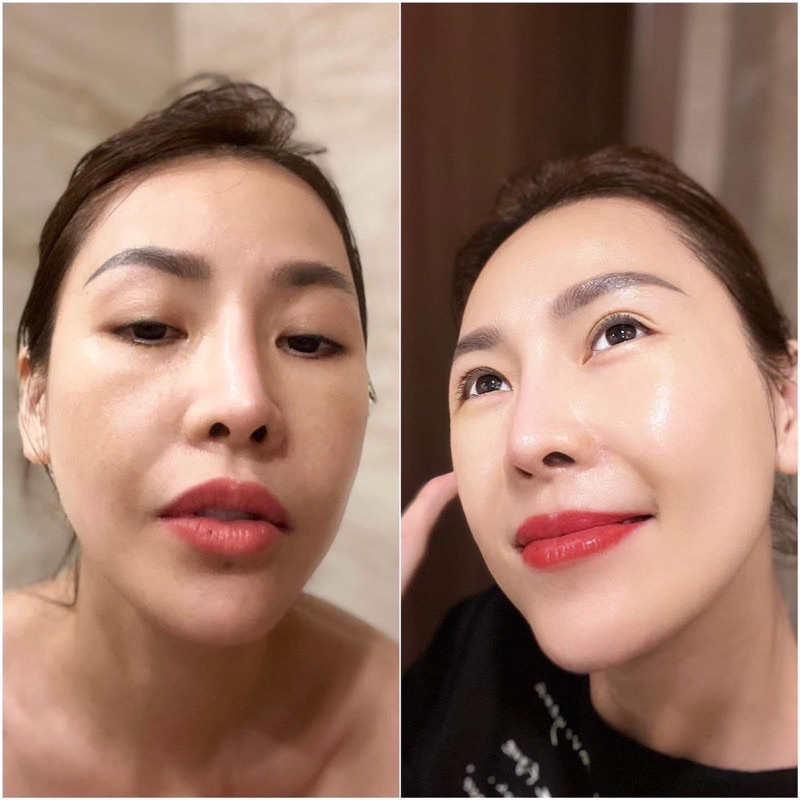 Serum nám moose+ xoá nám  50ml hạn dùng 2026