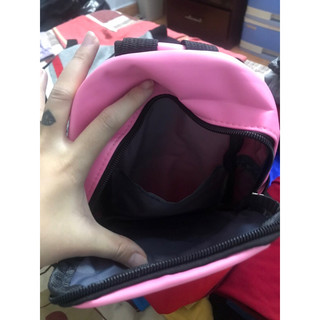 túi bao tử bé gái