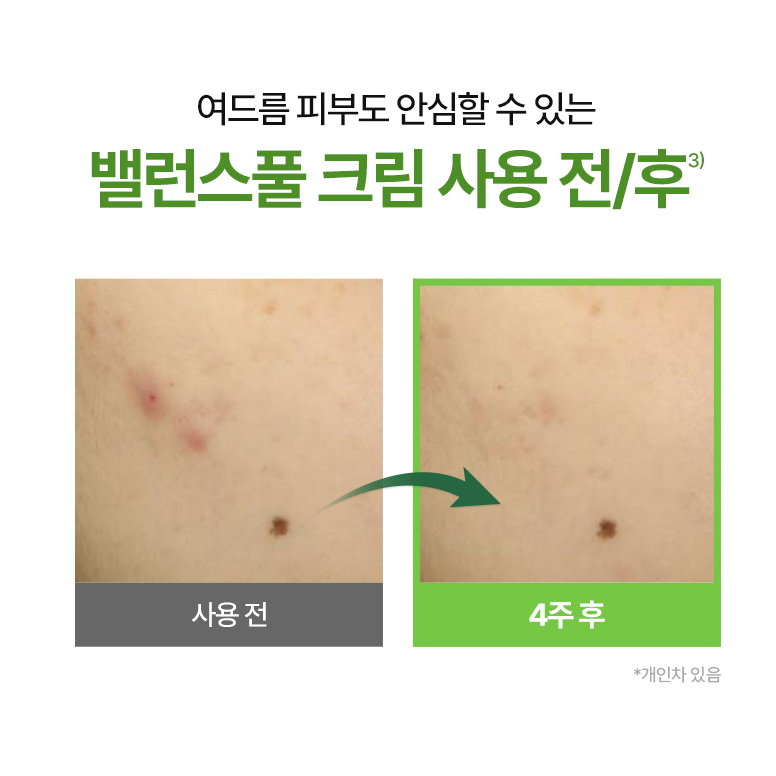 Kem dưỡng làm dịu da Torriden Balanceful Cream