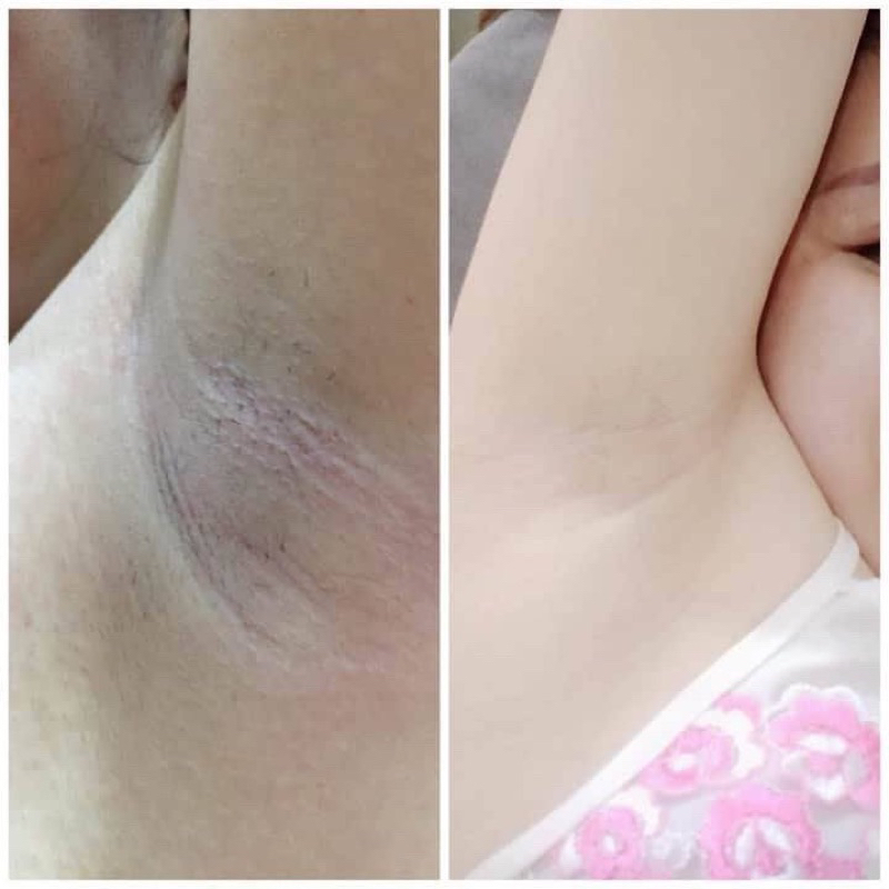 Kem Thâm nách Gluta Milk Thái Lan  giảm thâm, ngăn mùi cơ thể hiệu quả an toàn 15gr tặng kèm tuýp 10ml