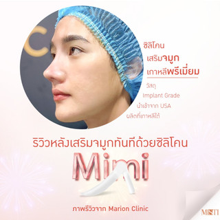 Sụn nâng mũi keosan Highko cao cấp