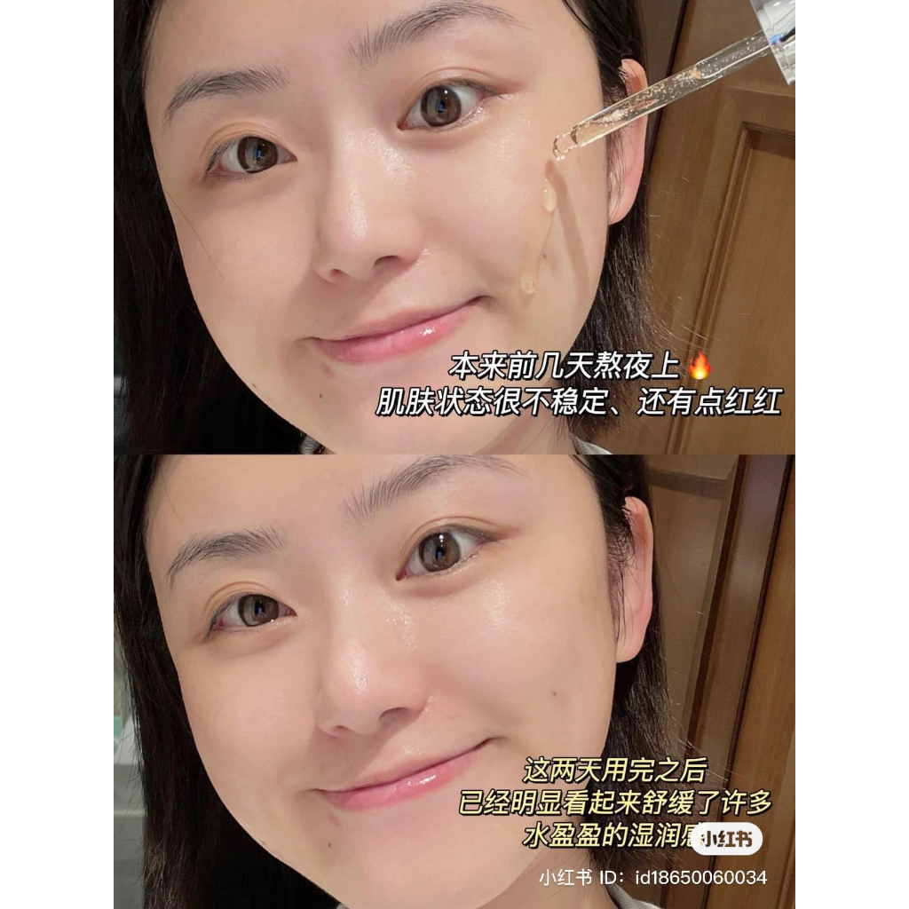 Tinh chất keo ong tái tạo phục hồi da CNP Laboratory Propolis Energy Active Ampule