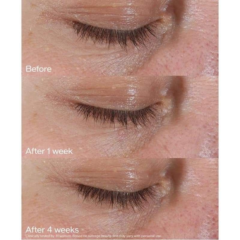 Kem dưỡng mắt Shi.seido Benefiance Winkle Smoothing Eye Cream