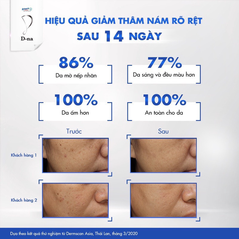 Viên uống sáng da giảm nám Glutathione Dna Whitening Supplement