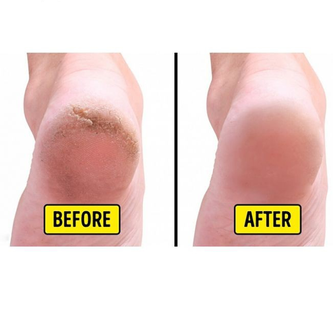 Kem Urea Cream Shiseido 100g Giảm Nứt Nẻ Chân Tay, Giảm Chai Sần, Mềm Mại Đầu Ngón Tay, Gót Chân Chính Hãng