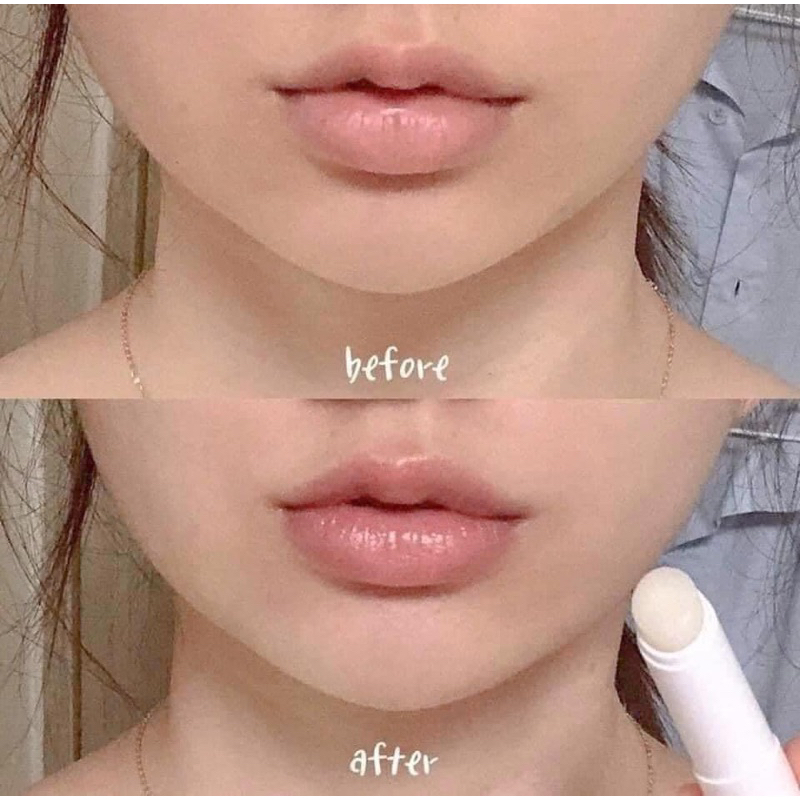 Son dưỡng môi Bio Atoderm Lèvres 4g