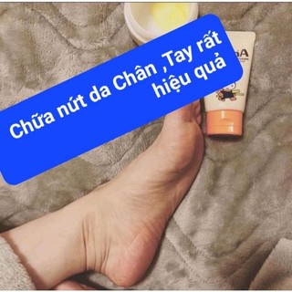 Kem nứt gót Da Chân,Tay YUSKIN A(date 6/2024)