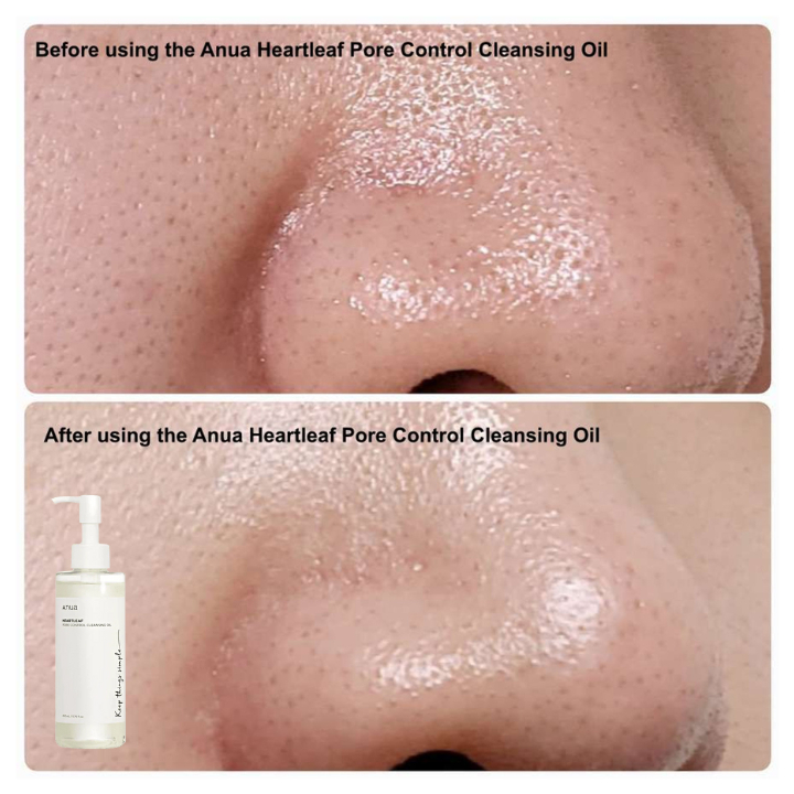 Dầu tẩy trang diếp cá Anua Heartleaf Pore Control Cleansing Oil 200ml