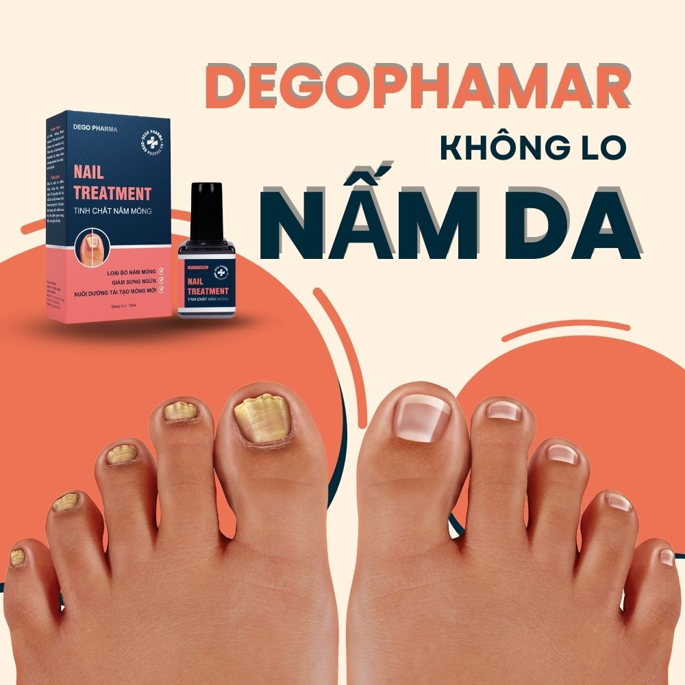 Tinh Chất Nấm Móng Dego Pharma - Hết Nấm Móng, Giảm Ngứa, Nuôi Dưỡng Tái Tạo Móng Mới