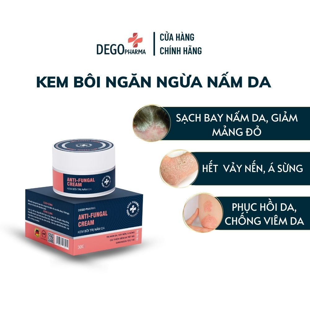 Kem bôi nấm da hắc lào mề đay vảy nến á sừng eczema Dego Pharma 30g