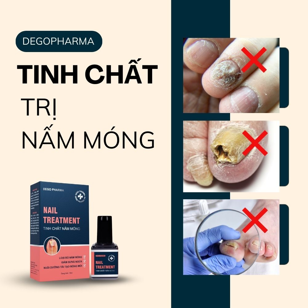 Tinh Chất Nấm Móng Dego Pharma - Hết Nấm Móng, Giảm Ngứa, Nuôi Dưỡng Tái Tạo Móng Mới