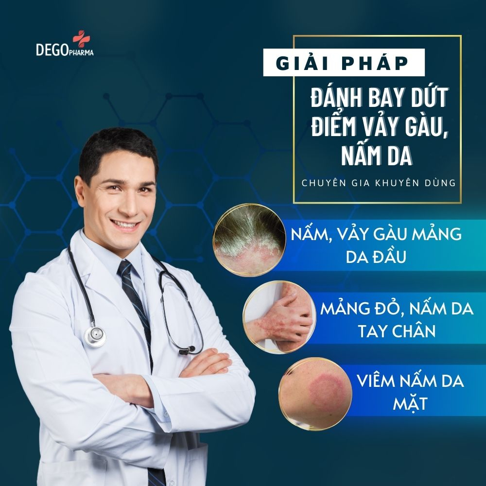 Kem bôi nấm da hắc lào mề đay vảy nến á sừng eczema Dego Pharma 30g