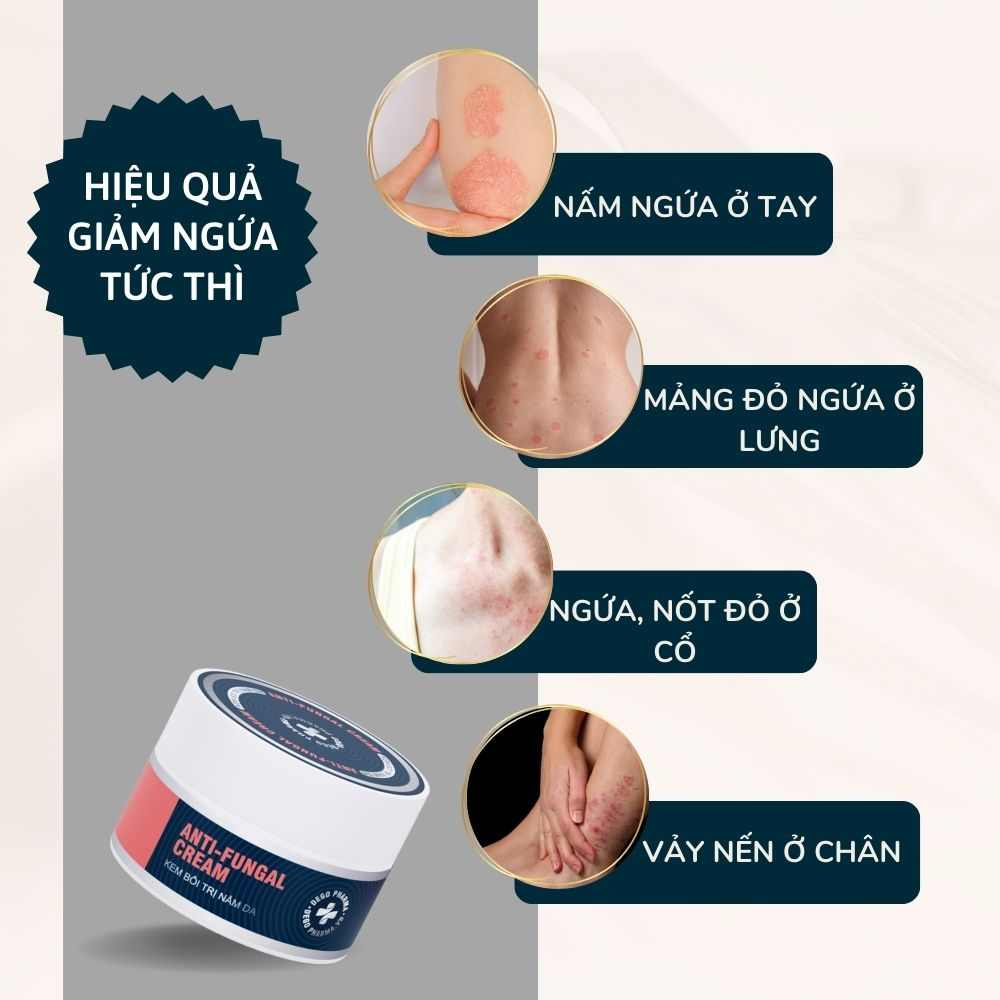 Kem bôi nấm da hắc lào mề đay vảy nến á sừng eczema Dego Pharma 30g