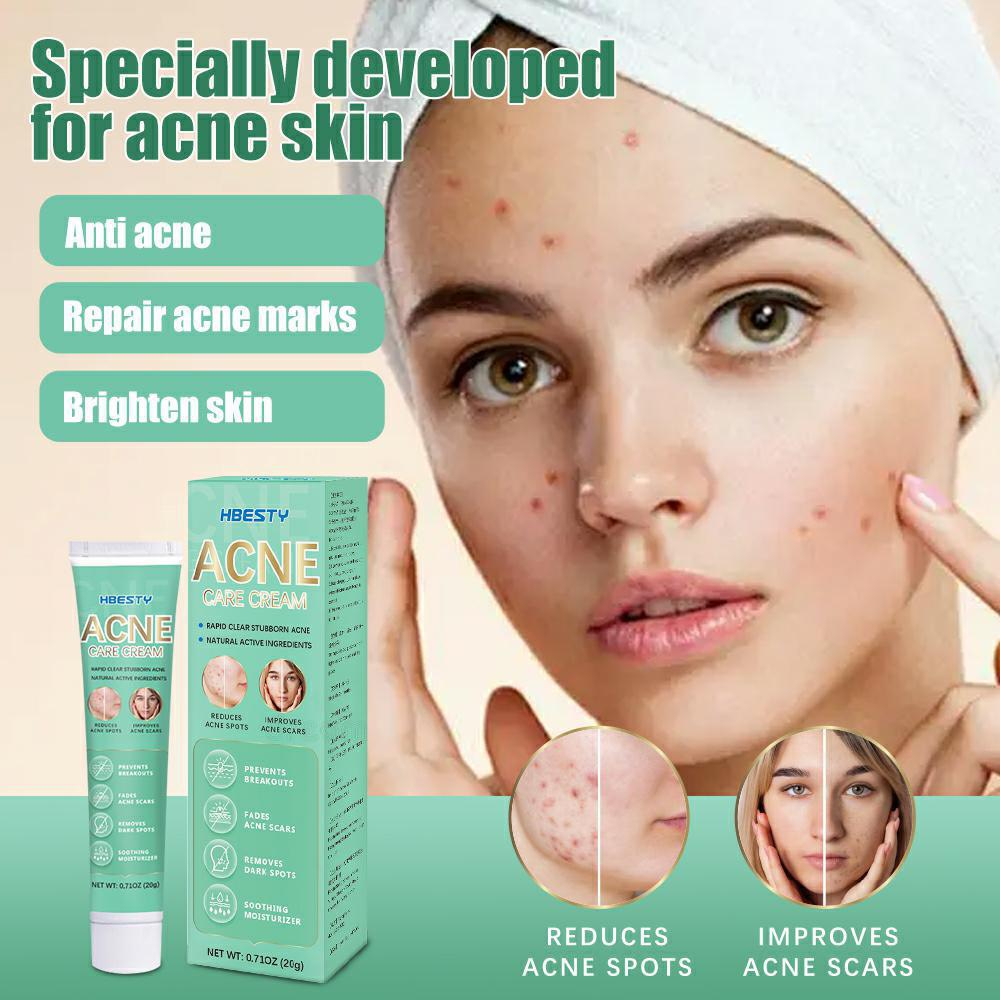 Acne Derm Kem giảm mụn, làm trắng da mờ thâm