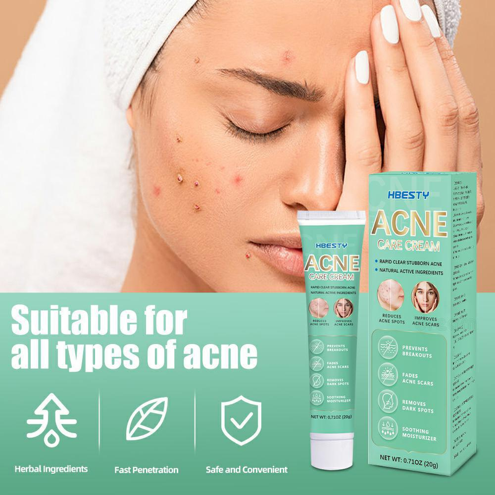 Acne Derm Kem giảm mụn, làm trắng da mờ thâm