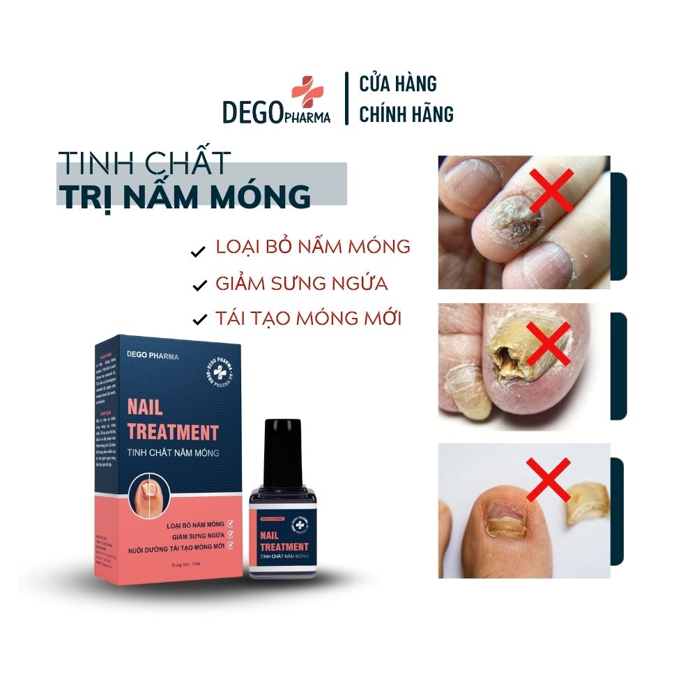 Tinh Chất Nấm Móng Dego Pharma - Hết Nấm Móng, Giảm Ngứa, Nuôi Dưỡng Tái Tạo Móng Mới