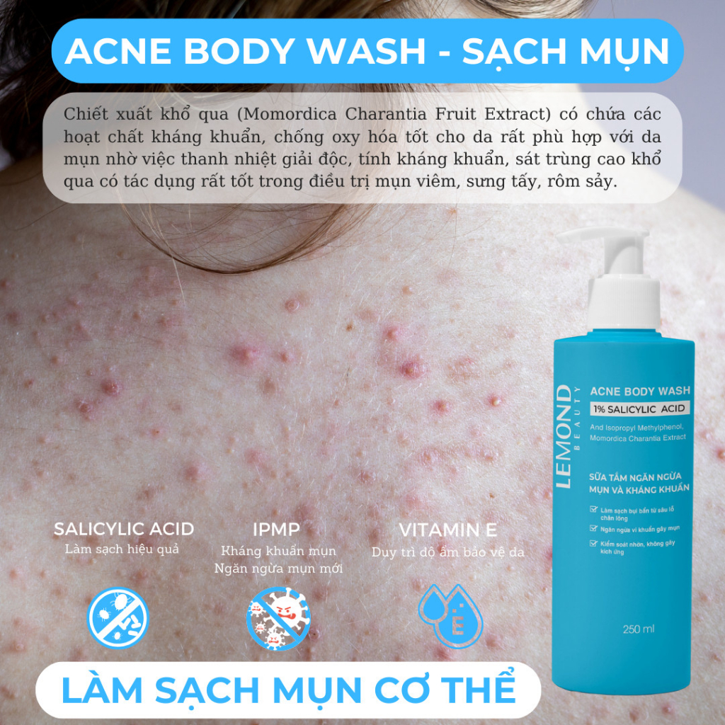 Sữa Tắm Sạch Mụn Lưng Giảm Thâm Mụn ALFASEPT Lemond Acne Body Wash 250ml Chiết Xuất Khổ Qua Ngừa Mụn, Dưỡng Ẩm Da