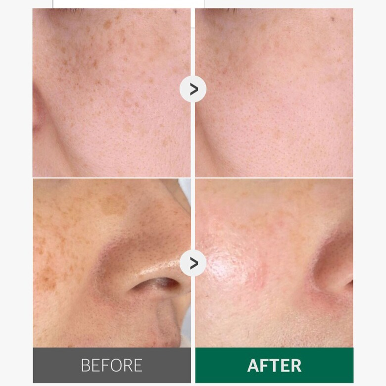 Tinh chất cà chua xanh SUNGBOON Editor Green Tomato Pore Lifting Ampoule