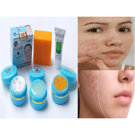 ⭐ CHUẨN LOẠI 1 ⭐ 𝗞𝗘𝗠 𝗠𝗨̣𝗡 𝗧𝗥𝗨̛́𝗡𝗚 𝗖𝗔́ , 𝗠𝗨̣𝗡 𝗧𝗛𝗔̂𝗠 , 𝗠𝗨̣𝗡 𝗩𝗜𝗘̂𝗠 𝗬𝗔𝗛𝗘𝗘 𝗧𝗛𝗔́𝗜 𝗟𝗔𝗡