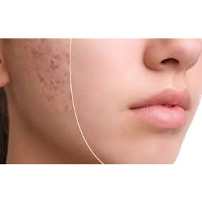 ⭐ CHUẨN LOẠI 1 ⭐ 𝗞𝗘𝗠 𝗠𝗨̣𝗡 𝗧𝗥𝗨̛́𝗡𝗚 𝗖𝗔́ , 𝗠𝗨̣𝗡 𝗧𝗛𝗔̂𝗠 , 𝗠𝗨̣𝗡 𝗩𝗜𝗘̂𝗠 𝗬𝗔𝗛𝗘𝗘 𝗧𝗛𝗔́𝗜 𝗟𝗔𝗡