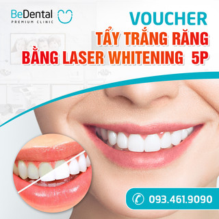 [E-voucher] Gói dịch vụ Tẩy trắng răng bằng phương pháp Laser Whitening 5P tại Nha khoa Bedental
